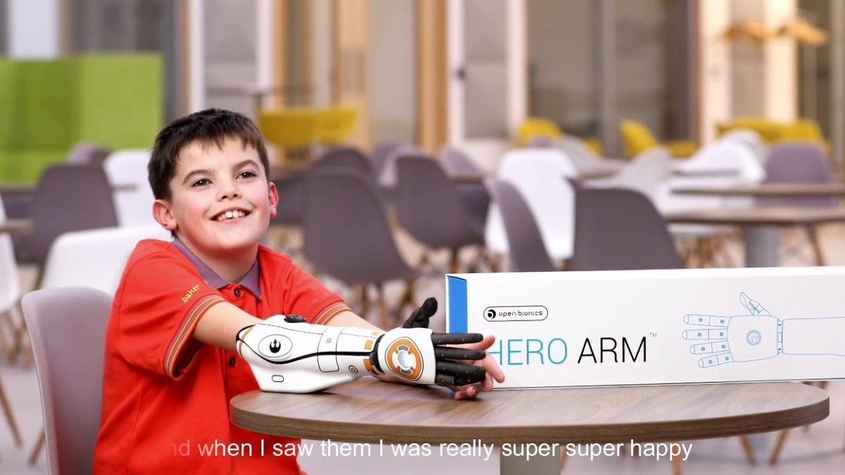 Open Bionics delivers an awesome BB-8 decorated bionic arm that delivers superheroic vibes all day long